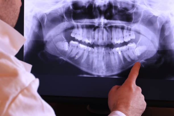 Best Emergency Gum Treatment in Richton, MS